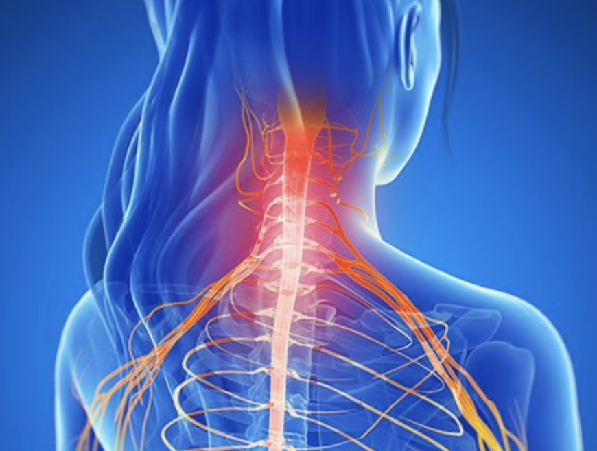 Laminectomy