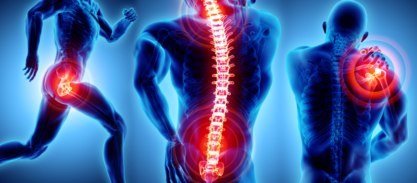 Everything You Need to Know About mild® for Spinal Stenosis: Pain Specialty  Group: Pain Management